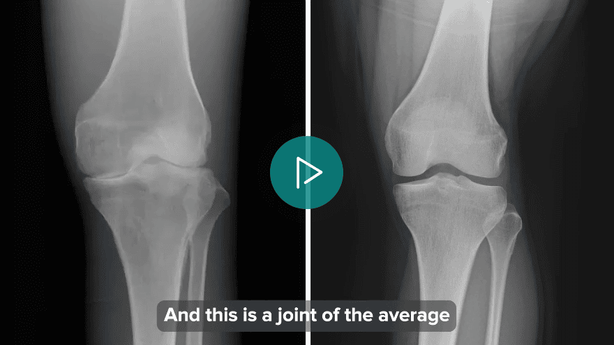 comparison